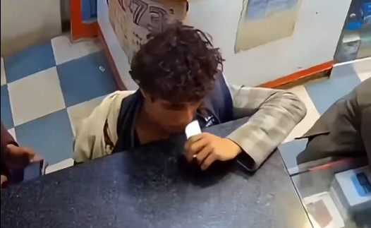 Video: Muerde la batería de su teléfono y le explota en la boca