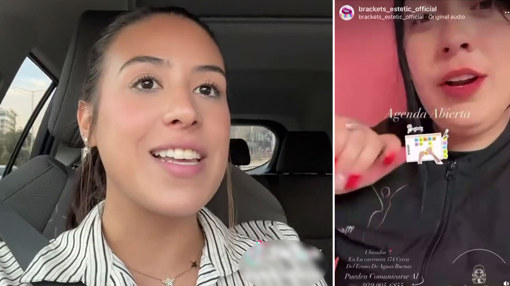 Video: Paciente de “Braces” habla de las ortodoncistas Boricuas fatulas