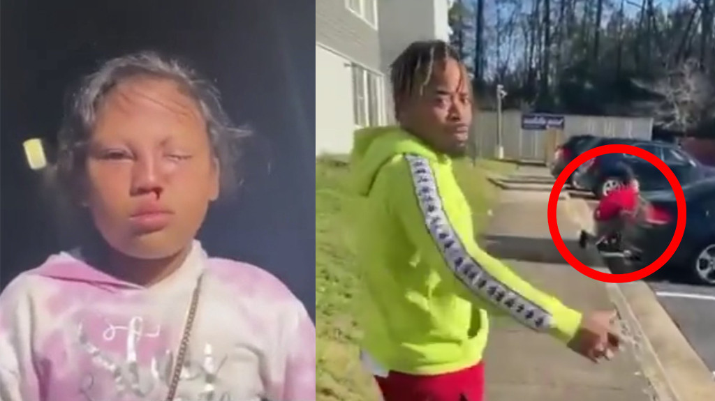 Video: Hombre golpea a una niña de 9 años y miren lo que le hizo el padre de la niña