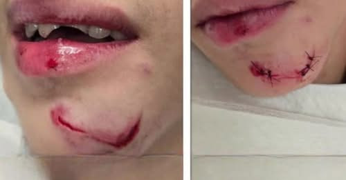 Video: Padre exige intervención de Educación tras violenta agresión a su hijo en plantel de Humacao