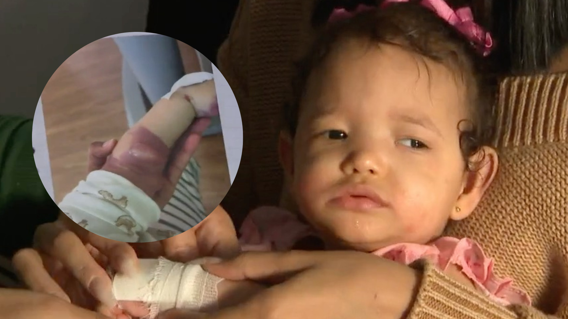 Video: Familia denuncia negligencia en hospital tras bebé sufrir quemaduras de segundo y tercer grado